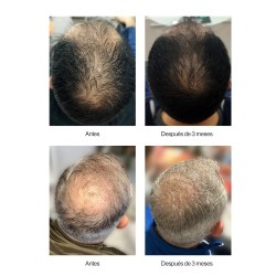 TH PHARMA NEOXIL-PEPTIDE PROGRAMA ANTIQUEDA (TRATAMENTO 50ML + CHAMPÔ)