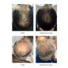 TH PHARMA NEOXIL-PEPTIDE PROGRAMA ANTIQUEDA (TRATAMENTO 50ML + CHAMPÔ)